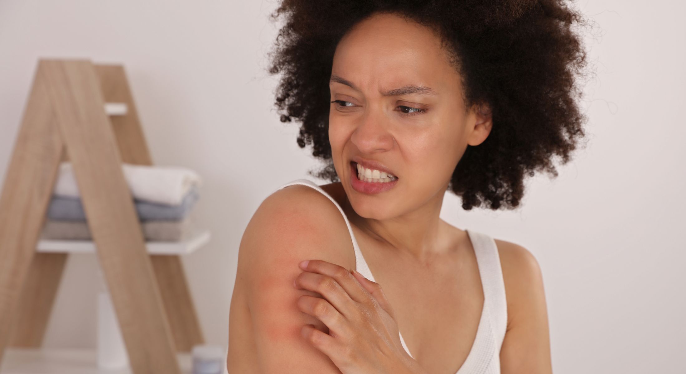 Alergias de pele - entenda as diferenças de cada uma e como tratá-las