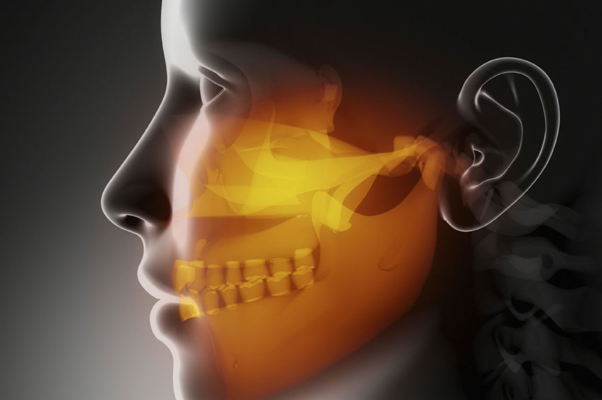 Artigo: Cirurgia Crânio-Maxilo-Facial:
