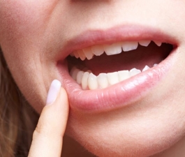 Gengivite é principal causa de perda dos dentes em idosos