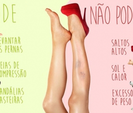 Perguntas e respostas sobre varizes