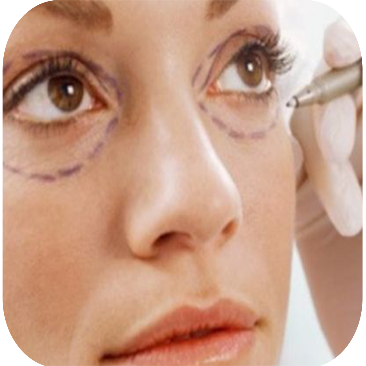 Cirurgias plásticas em pessoas acima dos 65 anos - número que não para de crescer