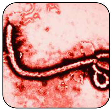 Saiba mais sobre o vírus Ebola