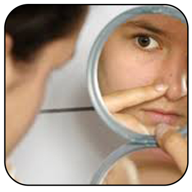 No verão tenha cuidado redobrado com a acne 