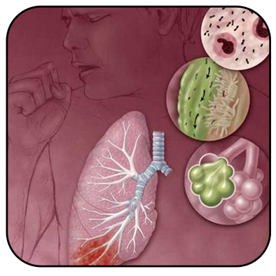 Infecções do trato respiratório superior: conheça mais esse problema