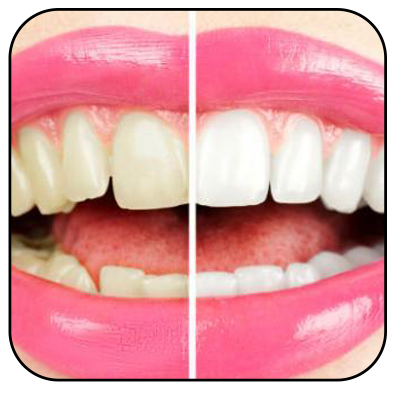 Conheça os alimentos escurecem os dentes 