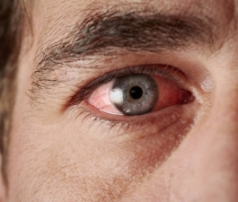 Especialista revela 7 dicas para controlar alergia ocular da primavera  