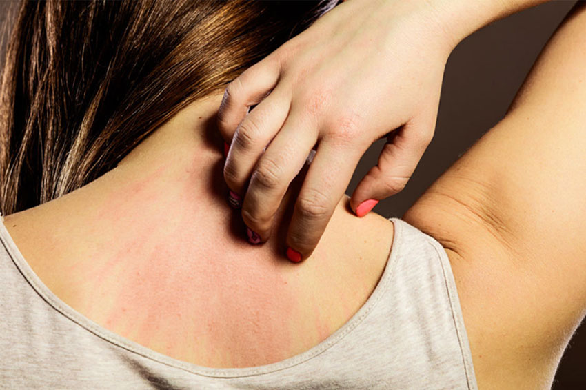 Erisipela: Especialista explica sintomas e prevenção