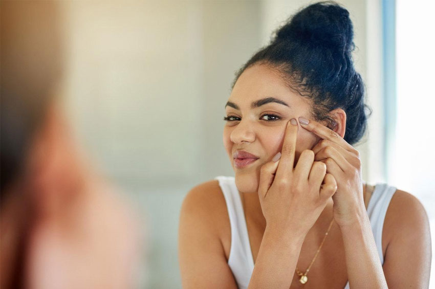 Acne adulta: relacionada a alterações hormonais e stress, problema exige visita ao dermatologista
