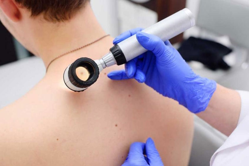  Melanoma: a pele também merece cuidados no inverno