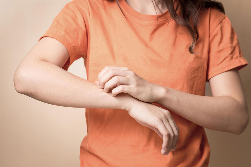 Dermatite atópica: conheça mitos e verdades e saiba como tratar