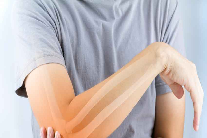 Osteoporose: ossos fortes desde a infância