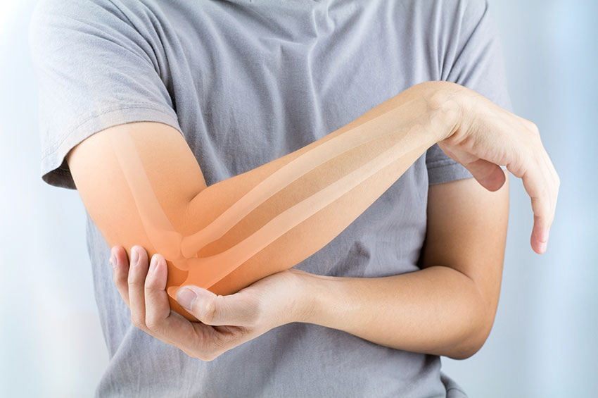 Mitos e verdades sobre a Osteoporose