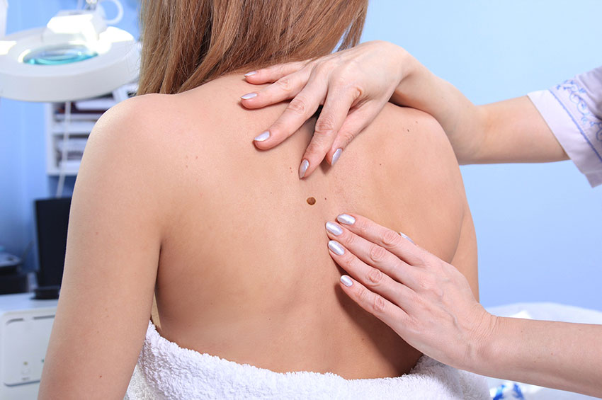 Cirurgia menos invasiva e mais efetiva permite o diagnóstico e tratamento do câncer de pele