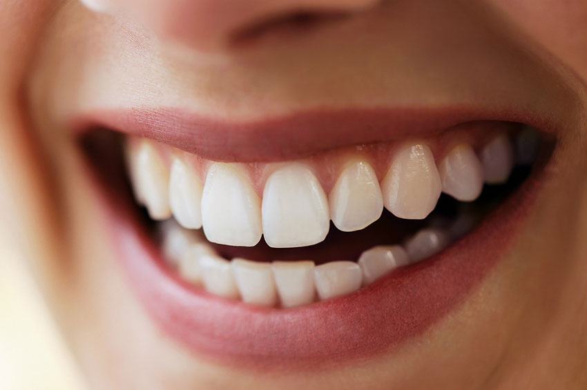 8 verdades e mitos sobre implantes dentários