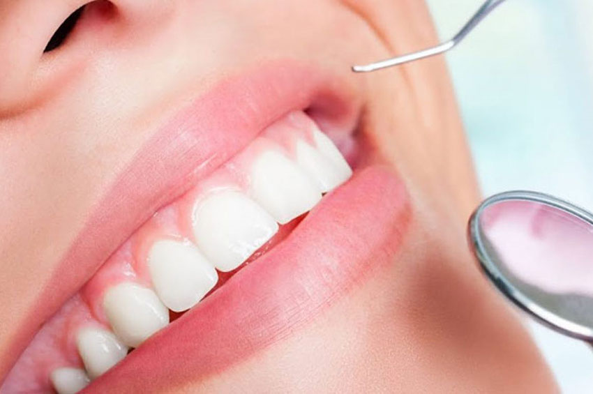 Mulheres são mais vulneráveis à perda dentária do que os homens
