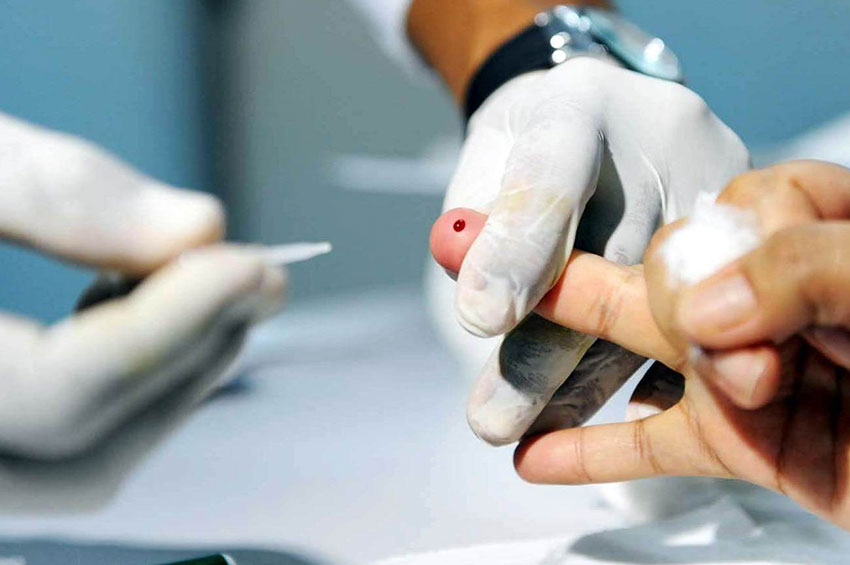 Cuidado com as hepatites virais pode prevenir câncer de fígado 