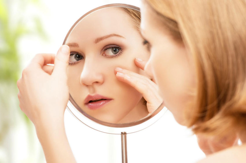 Cresce o número de casos de mulheres adultas com acne