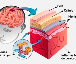 Meningite: Infectologista explica sintomas e vacinação