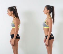Barriga saliente pode ser resultado da má postura