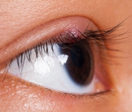 Calázio e hordéolo (terçol) - Distúrbios oftalmológicos - Manuais