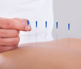 Acupuntura complementa tratamentos odontológicos