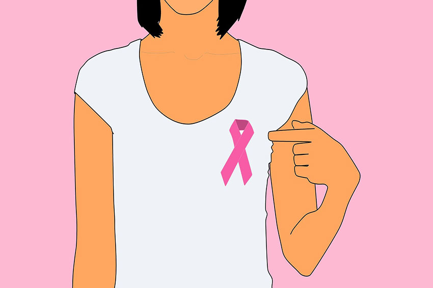 A radioterapia na mama é segura para coração e pulmão?