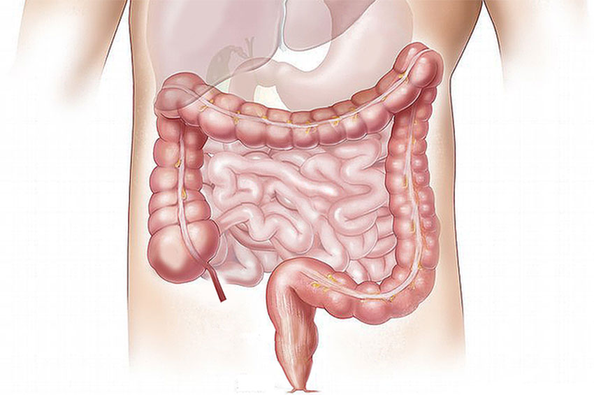 Colonoscopia dói? Conheça mitos e verdades sobre o exame