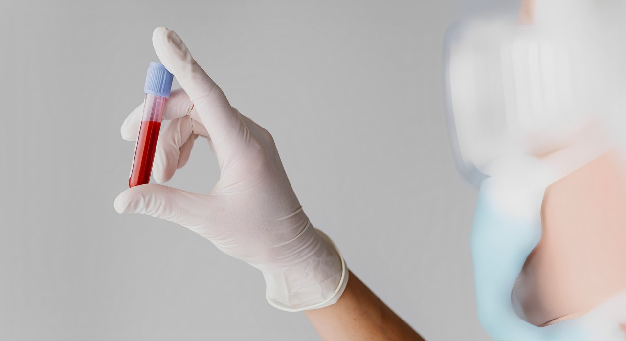 EUA aprovam novo exame de sangue para detecção do câncer colorretal