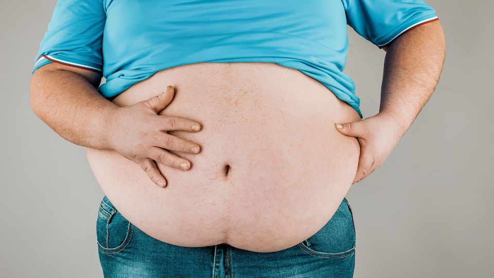 Artigo - As inúmeras faces da obesidade: uma doença multifatorial na medicina da obesidade e emagrecimento