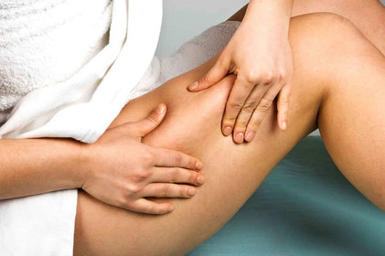 Celulite: É possível tratar ou prevenir? 