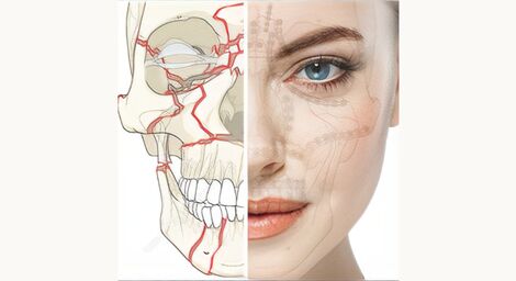 Artigo - O uso do Capacete de Crawford nas Fraturas dos Ossos do Crânio e Face em Cirurgia Maxilofacial
