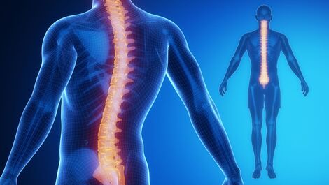 Dia Mundial da Coluna Vertebral: Entenda como sua postura pode gerar dores de coluna