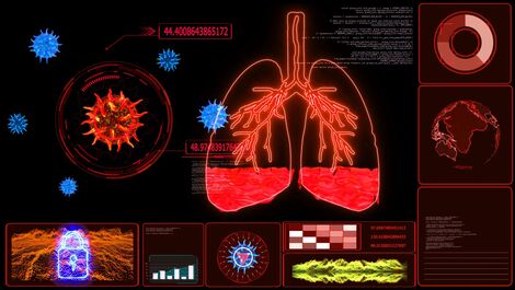 Embolia pulmonar: entenda como prevenir a condição relacionada à trombose que pode causar morte súbita