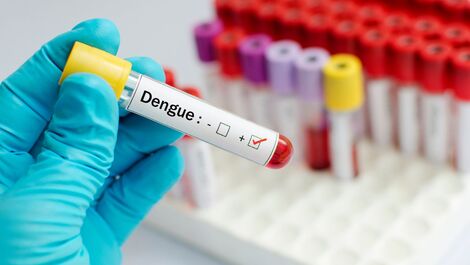 Confira 7 principais dúvidas sobre a nova vacina contra a dengue