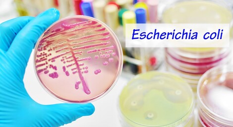 E. coli: entenda o que é a bactéria encontrada em hambúrguer do McDonald