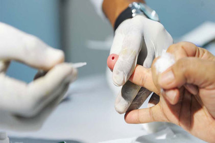 Hepatites virais causam mais de 74 mil mortes em dez anos