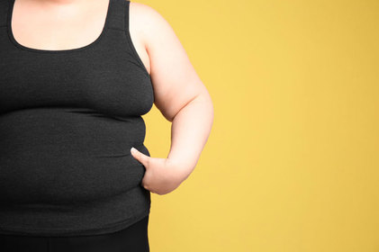 Especialista aponta 10 mitos e verdades sobre a obesidade