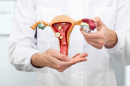 Sangramento anormal pode ser sintoma de Pólipo Endometrial